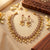 Dazzle Queen Set